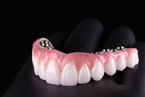 The Safety And Efficacy Of Implant Supported Dentures