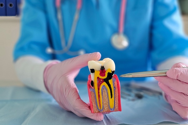 Root Canal Vs  Extraction: Make The Right Choice For Your Oral Health